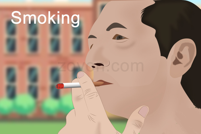 smoke inhalation,don\\'tsmoke expert guide that covers causes & prevention of fine lines