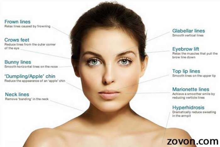 botox uses and applications