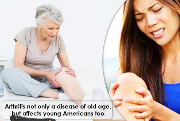 arthritis not only a disease of old age but affects young americans too