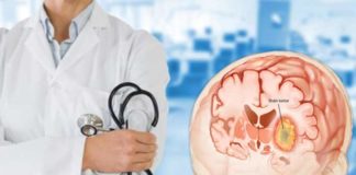 brain tumors symptoms and treatment