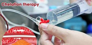 chelation therapy how and when