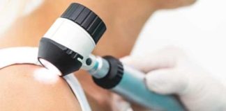 delaying melanoma treatment for just a month can be deadly