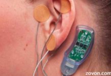 fda approves nerve stimulator for people facing opioid withdrawal symptoms