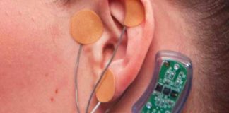 fda approves nerve stimulator for people facing opioid withdrawal symptoms