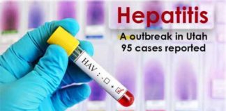 hepatitis a outbreak in utah 95 cases reported