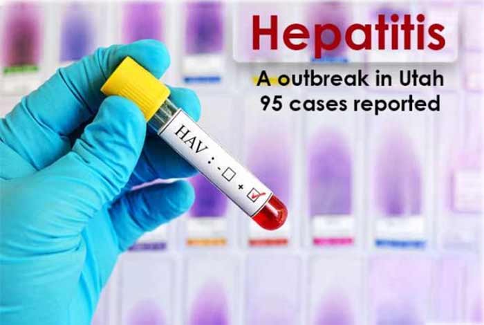 hepatitis a outbreak in utah 95 cases reported