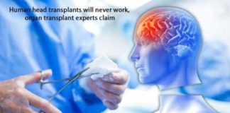 human head transplants will never work organ transplant experts claim