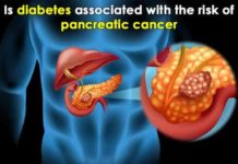 is diabetes associated with the risk of pancreatic cancer