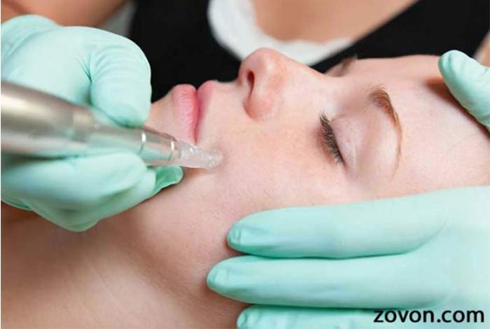 mesotherapy skin care and anti aging benefits