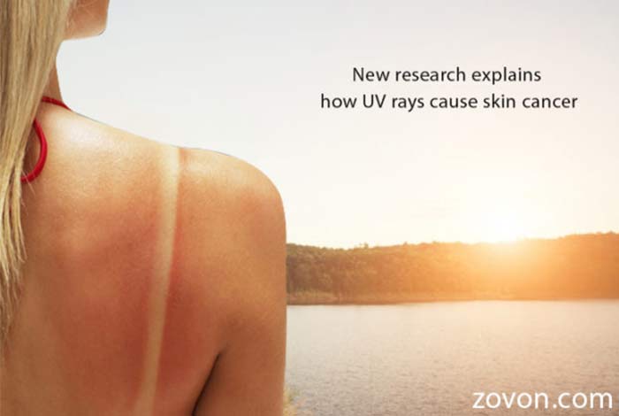 new research explains how uv rays cause skin cancer