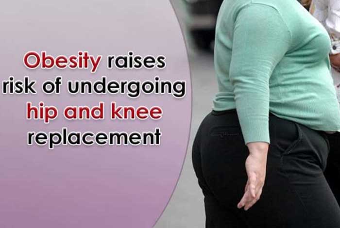 obesity raises risk of undergoing hip and knee replacement