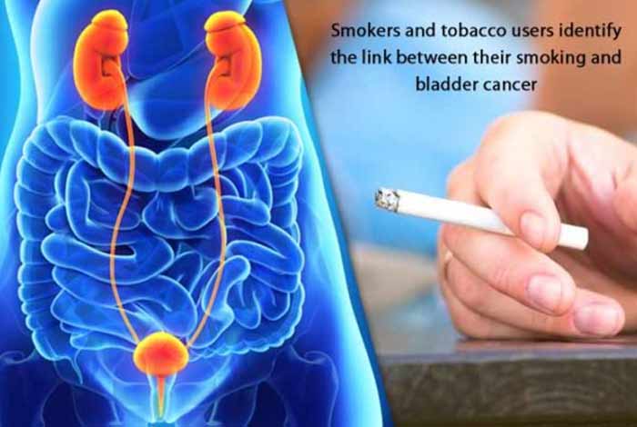 smokers and tobacco users identify the link between their smoking and bladder cancer