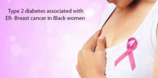 type 2 diabetes associated with er breast cancer in black women