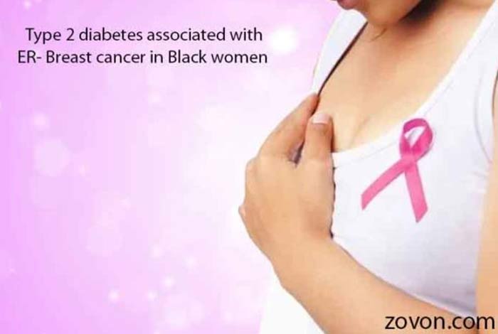 type 2 diabetes associated with er breast cancer in black women