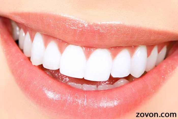 whiten your teeth to look brighter