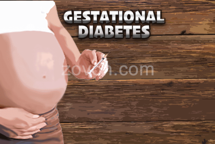 Gestational Diabetes