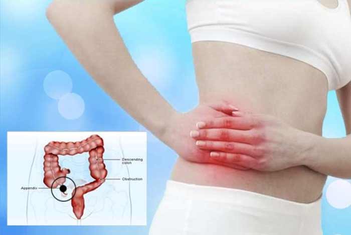 appendicitis types symptoms causes prevention and treatment