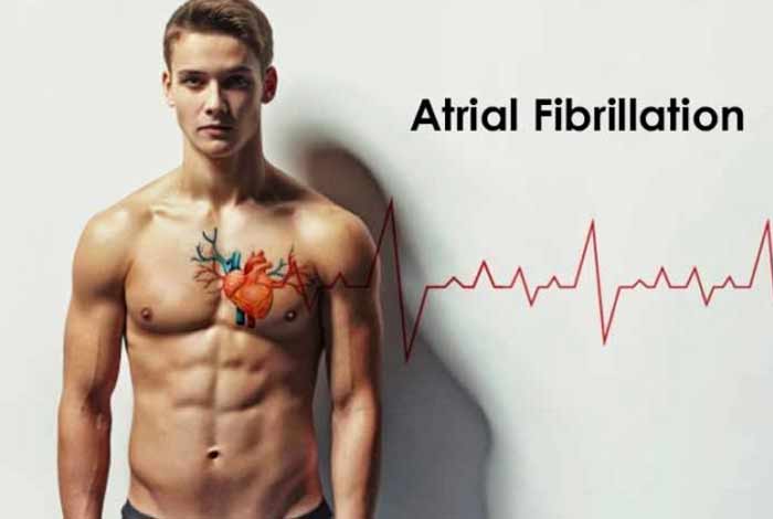 atrial fibrillation symptoms causes prevention and treatment