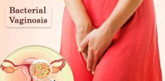 bacterial vaginosis treatment along with symptoms types and prevention methods