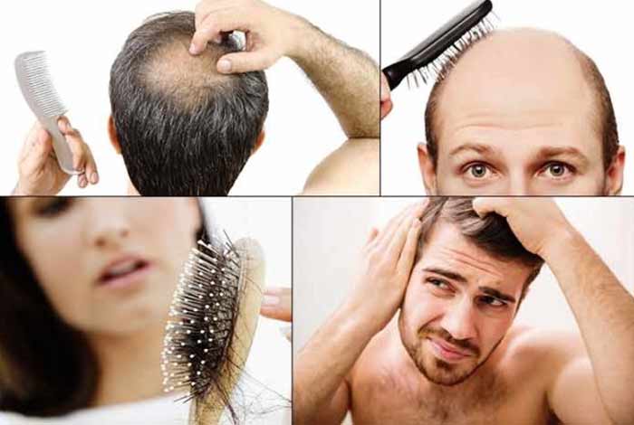 baldness symptoms causes pattern prevention and treatment