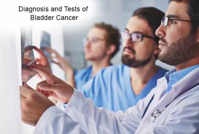diagnosis and tests of bladder cancer
