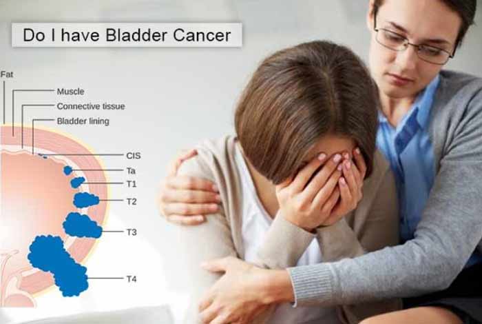 do i have bladder cancer