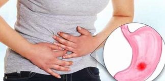 irritable bowel syndrome ibs types causes prevention and treatment
