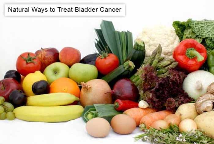natural ways to treat bladder cancer