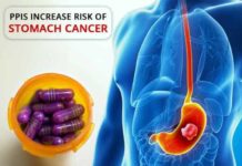 ppis increase risk of stomach cancer