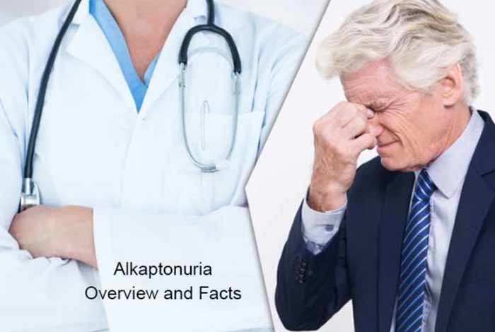 alkaptonuria symptoms causes prevention and treatment