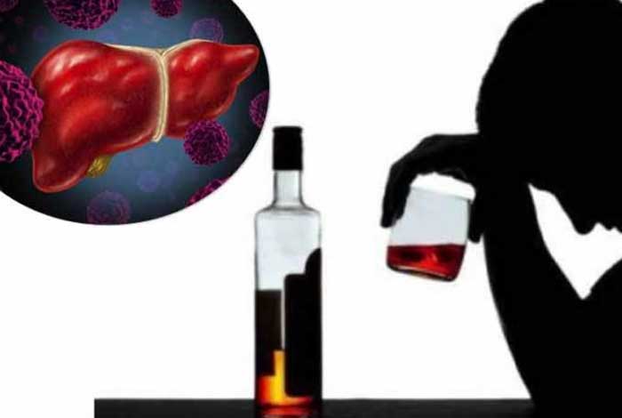 causes of liver cirrhosis