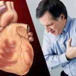 coronary artery disease types symptoms causes risk factors and treatment