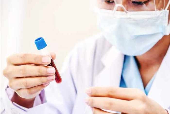 diagnosis and tests of viral hepatitis