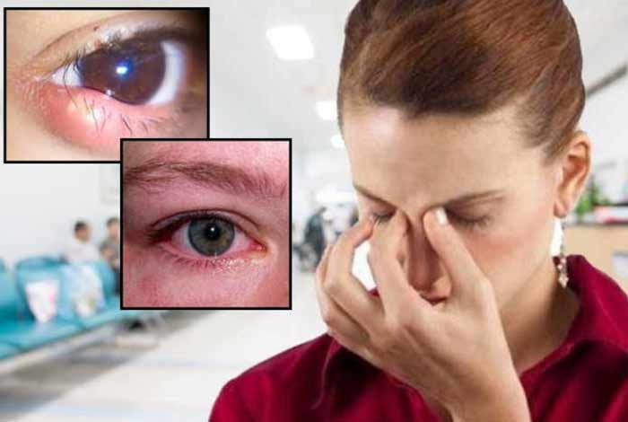 eye related symptoms