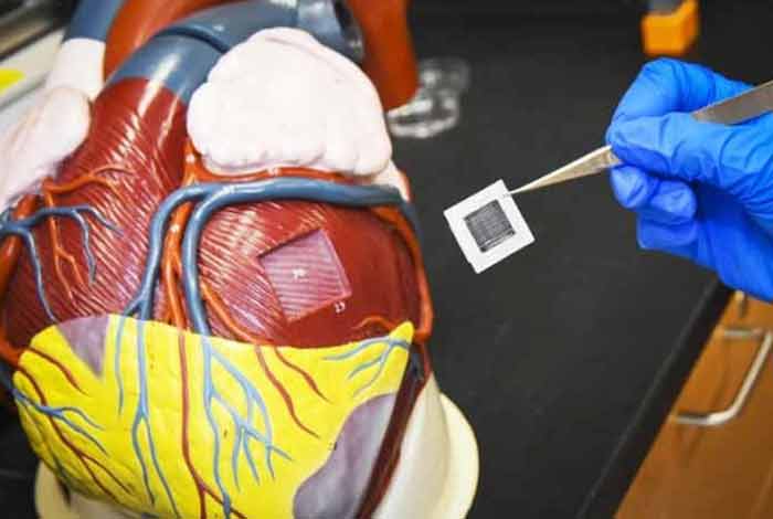 large heart muscle patches from human heart cells improve recovery from heart attack