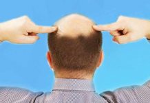 restores your hair growth home-remedies for baldness in men
