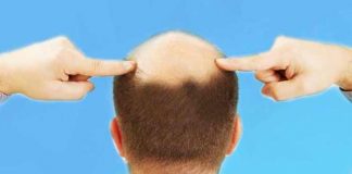 restores your hair growth home-remedies for baldness in men