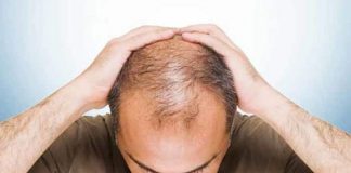 top 17 effectively useful home remedies for baldness