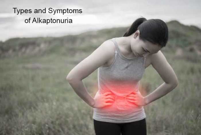  types and symptoms of alkaptonuria