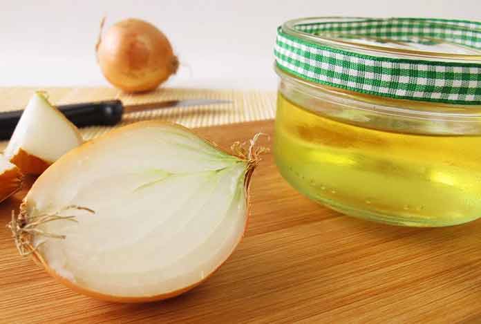 Onion Juice for 7 Most Effective Home Remedies for Hair Thinning