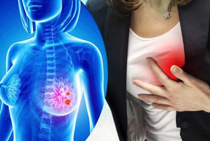 breast cancer treatment might increase risk of cardiovascular diseases