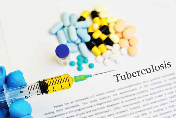 Line of Action Against TB