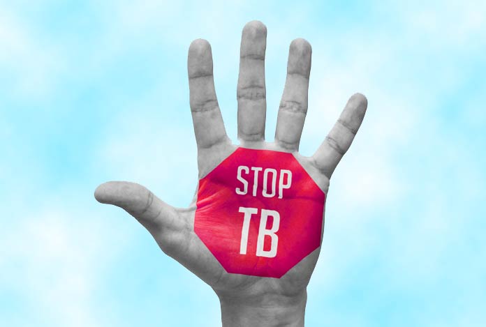 Stop TB Strategy 2011-2015