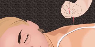 Can Acupuncture Help Relieve Back Pain1