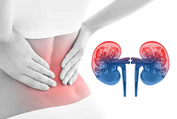 relation between ckd and lupus nephropathy in women