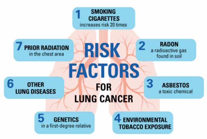 risk factors of lung cancer