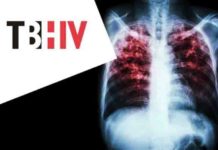 tuberculosis world’s deadliest infection alongside aids