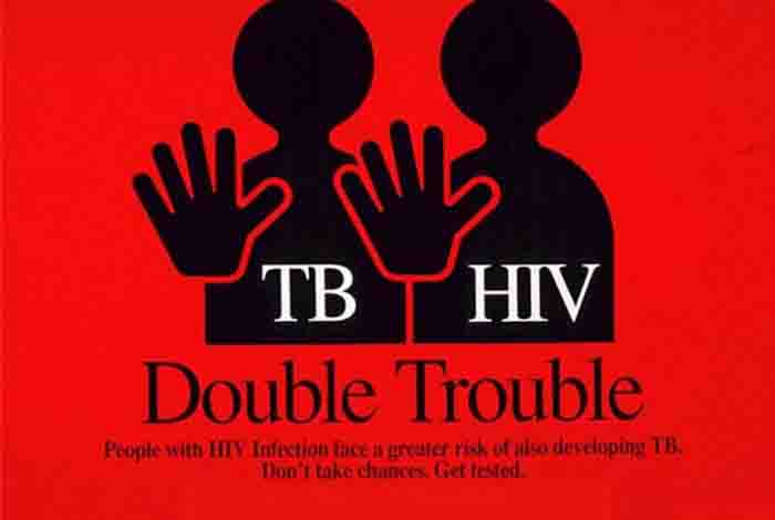 tuberculosis and aids 