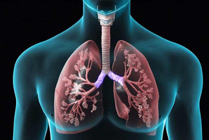 types and symptoms of copd