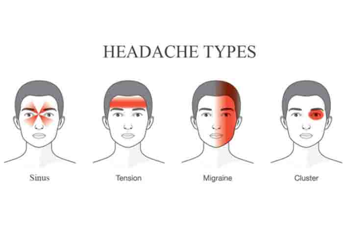 types of headic 